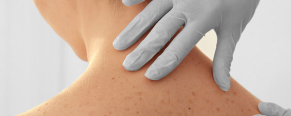 Dezembro Laranja alerta para a prevenção do câncer de pele